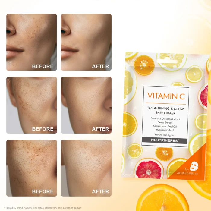 Glowing Vitamin C Facial Mask For Nourishing Skin And Reducing Redness - Image 3