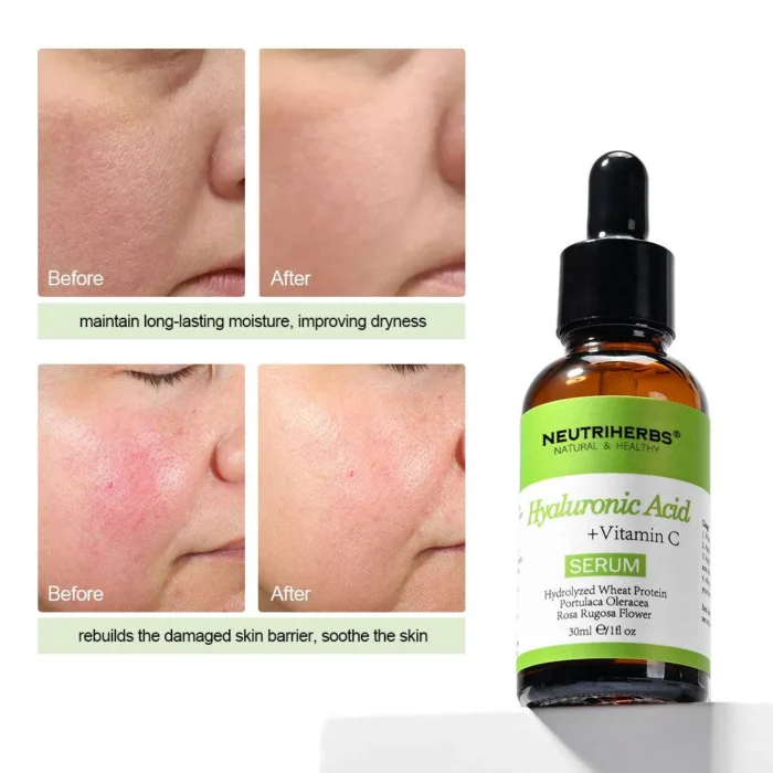 Best Hyaluronic Acid Serum For Oily Skin - Image 5