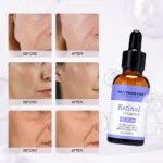 Retinol Serum Helps Defend Against Signs Of Aging - Image 12