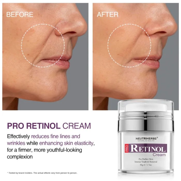PRO Retinol Cream For Wrinkles And Acne Marks - Image 8