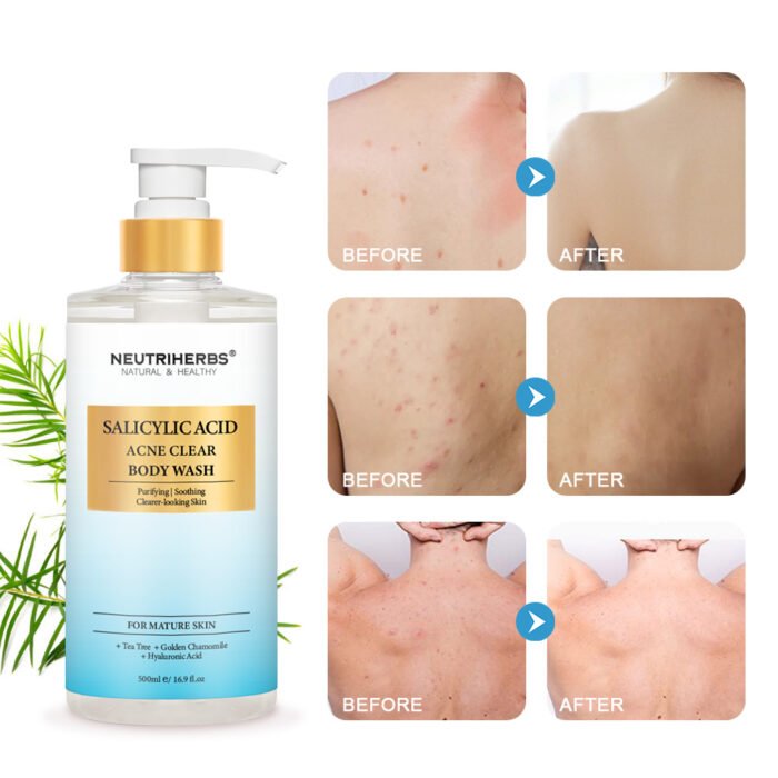 Acne Clear Salicylic Acid Body Wash - Image 7