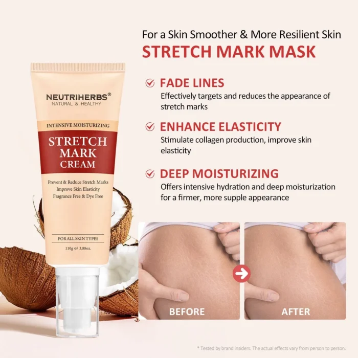 Body Stretch Mark Cream For A Smoother and Resilient Skin - Image 9