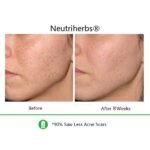 Best Duo For Dull Skin with Wrinkles & Dark Spots - Image 4