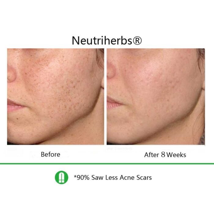 Best Duo For Dull Skin with Wrinkles & Dark Spots - Image 4