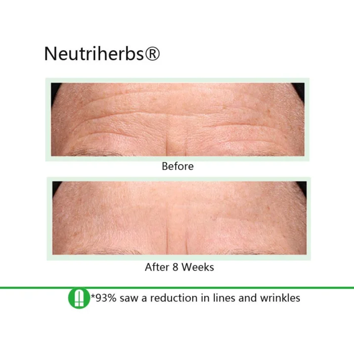 Neutriherbs Retinol Cream + Hyaluronic Acid Serum For Dry Skin - Image 6