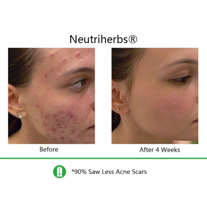 Neutriherbs Retinol Cream + Hyaluronic Acid Serum For Dry Skin - Image 5